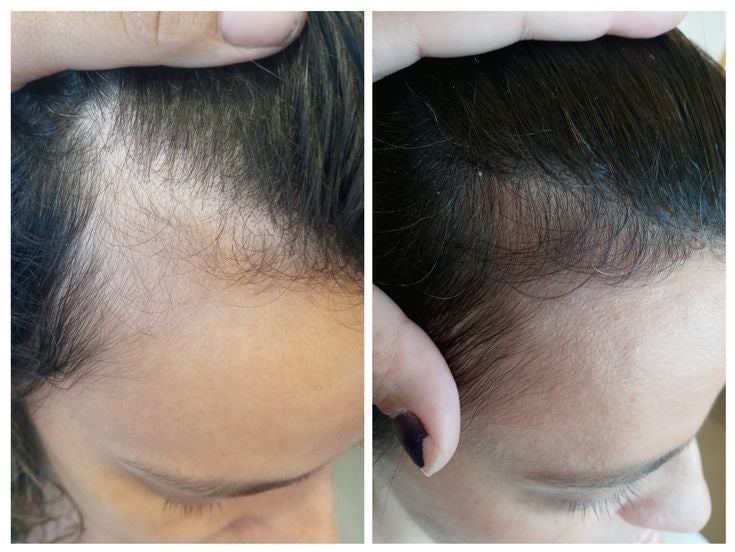 L'huile de Cheveux Anti-chute