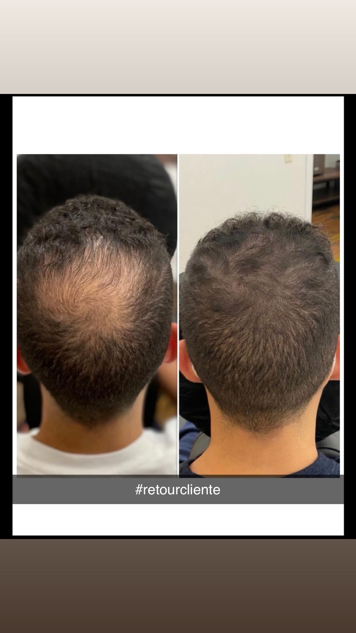 L'huile de Cheveux Anti-chute