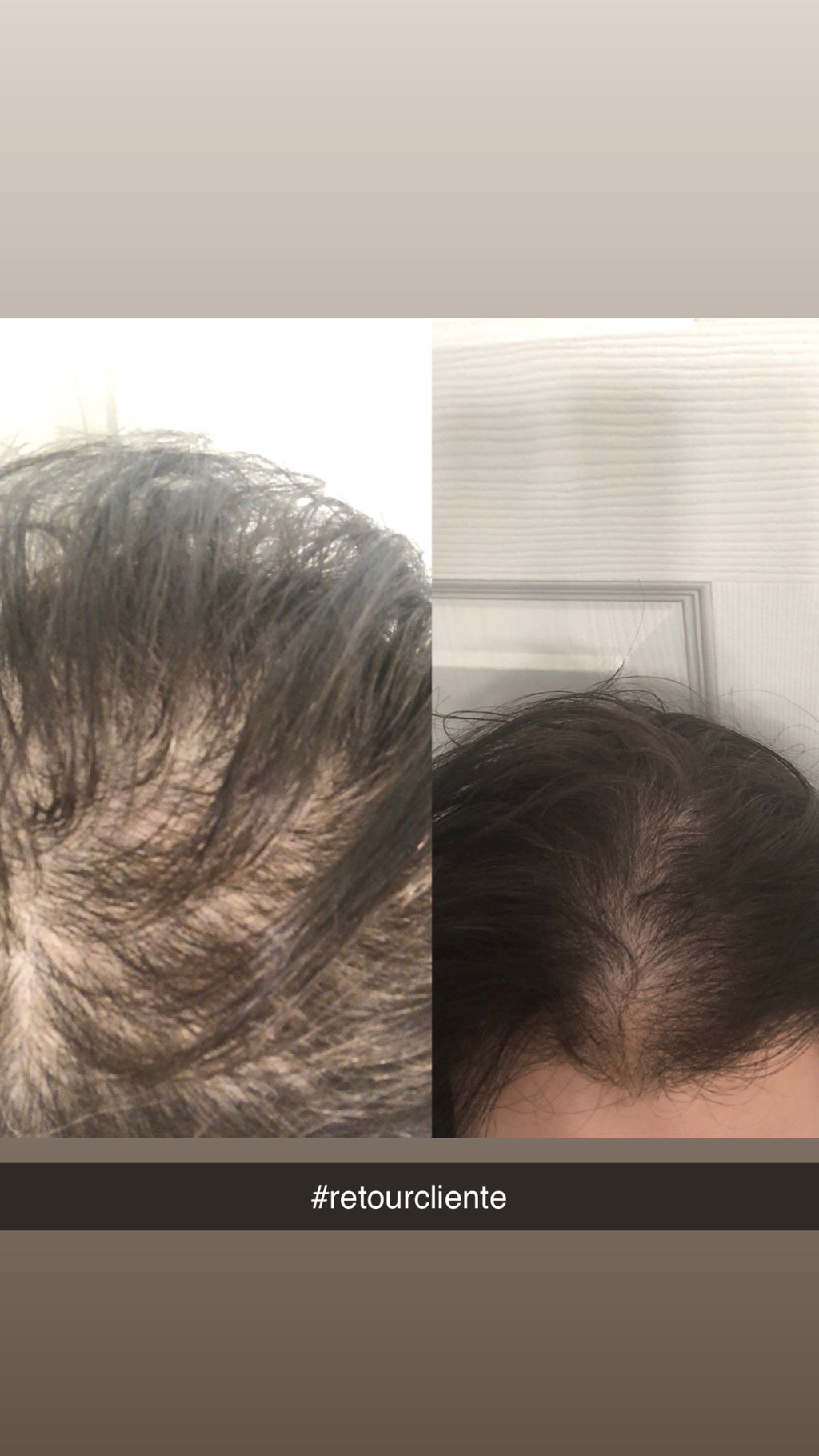 L'huile de Cheveux Anti-chute