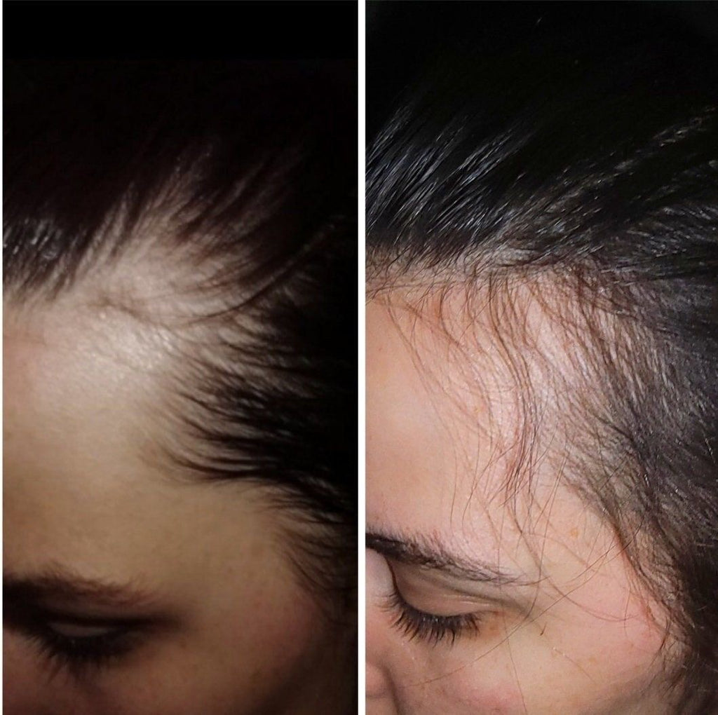 L'huile de Cheveux Anti-chute