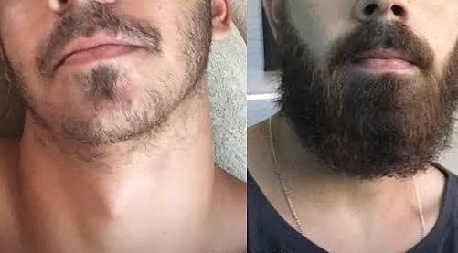 L'huile De Barbe
