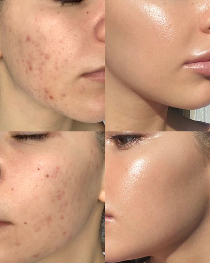 Poudre Nettoyante Visage Naturelle